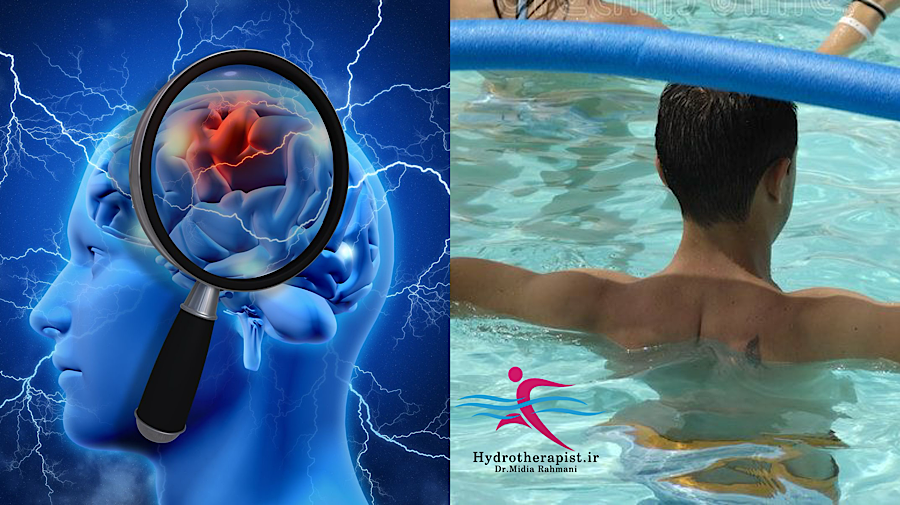 تأثیر آب‌درمانی بر بیماران سکته مغزی